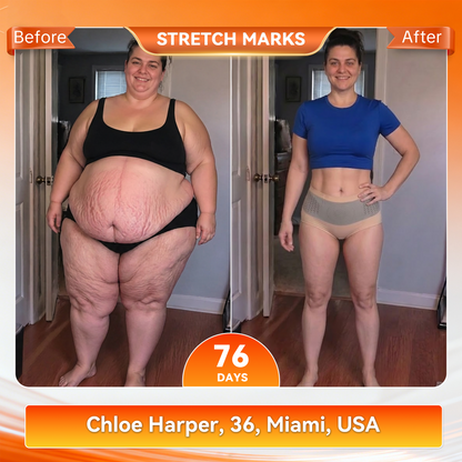 𝐎𝐟𝐟𝐢𝐜𝐢𝐚𝐥 𝐁𝐫𝐚𝐧𝐝 𝐒𝐭𝐨𝐫𝐞 🇺🇸| 𝐙𝐔𝐄𝐄𝐓® 𝟐𝟎𝟐𝟔 𝐌𝐨𝐫𝐢𝐧𝐠𝐚 x 𝐁𝐞𝐫𝐛𝐞𝐫𝐢𝐧𝐞 x 𝐍𝐀𝐃+ 𝟔-𝐈𝐧-𝟏 𝐌𝐢𝐜𝐫𝐨-𝐏𝐚𝐫𝐭𝐢𝐜𝐥𝐞 𝐒𝐜𝐮𝐥𝐩𝐭𝐢𝐧𝐠 & 𝐅𝐚𝐭-𝐁𝐮𝐫𝐧 𝐒𝐡𝐨𝐫𝐭𝐬 (Women + Men with Enhanced Male Vitality Blend)
