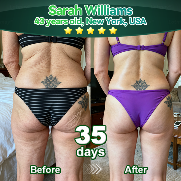 𝑳𝒐𝒕𝑚𝑎𝑦® 𝑺𝑡𝑒𝑚 𝑪𝑒𝑙𝑙 & 𝑪𝑜𝑙𝑙𝑎𝑔𝑒𝑛 𝑷𝑒𝑝𝑡𝑖𝑑𝑒 𝑶𝑟𝑎𝑙 𝑫𝑟𝑜𝑝𝑠 (𝑳𝑖𝑓𝑡 & 𝑭𝑖𝑟𝑚 𝑺𝑎𝑔𝑔𝑖𝑛𝑔 𝑺𝑘𝑖𝑛 & 𝑹𝑒𝑑𝑢𝑐𝑒 𝑾𝑟𝑖𝑛𝑘𝑙𝑒 𝑭𝑜𝑟𝑚𝑎𝑡𝑖𝑜𝑛) 💎