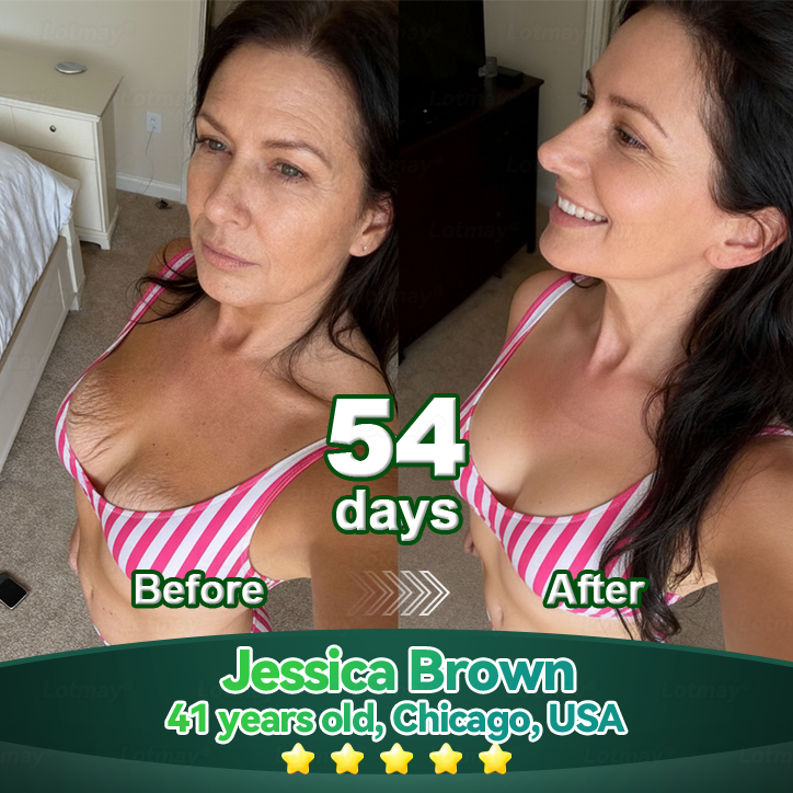 1𝑳𝒐𝒕𝑚𝑎𝑦® 𝑺𝑡𝑒𝑚 𝑪𝑒𝑙𝑙 & 𝑪𝑜𝑙𝑙𝑎𝑔𝑒𝑛 𝑷𝑒𝑝𝑡𝑖𝑑𝑒 𝑶𝑟𝑎𝑙 𝑫𝑟𝑜𝑝𝑠 (𝑳𝑖𝑓𝑡 & 𝑭𝑖𝑟𝑚 𝑺𝑎𝑔𝑔𝑖𝑛𝑔 𝑺𝑘𝑖𝑛 & 𝑹𝑒𝑑𝑢𝑐𝑒 𝑾𝑟𝑖𝑛𝑘𝑙𝑒 𝑭𝑜𝑟𝑚𝑎𝑡𝑖𝑜𝑛) 💎