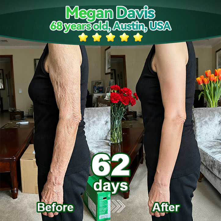 𝑳𝒐𝒕𝑚𝑎𝑦® 𝑺𝑡𝑒𝑚 𝑪𝑒𝑙𝑙 & 𝑪𝑜𝑙𝑙𝑎𝑔𝑒𝑛 𝑷𝑒𝑝𝑡𝑖𝑑𝑒 𝑶𝑟𝑎𝑙 𝑫𝑟𝑜𝑝𝑠 (𝑳𝑖𝑓𝑡 & 𝑭𝑖𝑟𝑚 𝑺𝑎𝑔𝑔𝑖𝑛𝑔 𝑺𝑘𝑖𝑛 & 𝑹𝑒𝑑𝑢𝑐𝑒 𝑾𝑟𝑖𝑛𝑘𝑙𝑒 𝑭𝑜𝑟𝑚𝑎𝑡𝑖𝑜𝑛) 💎